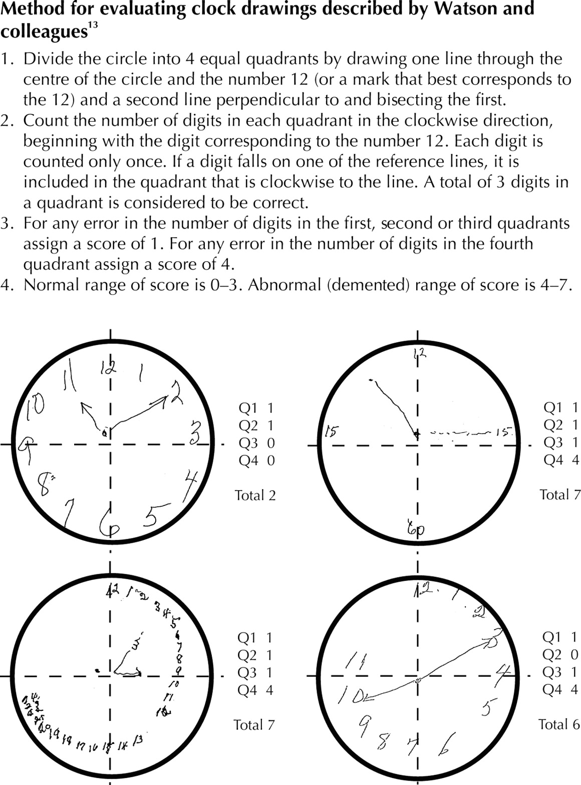 Baycrest Foundation - The Clock Drawing Test: A Quick and