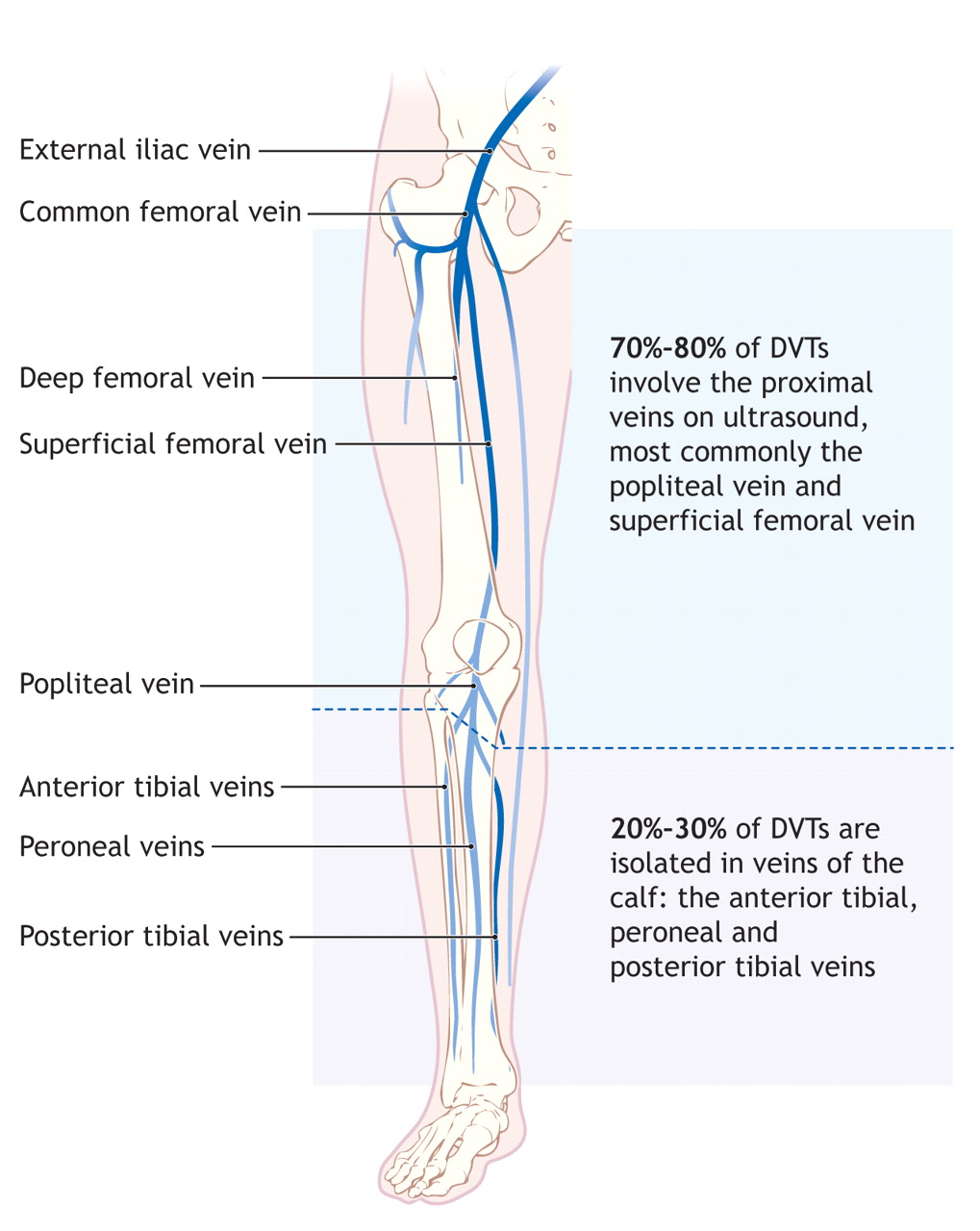 What is Deep Vein Thrombosis? - Western Vascular Institute