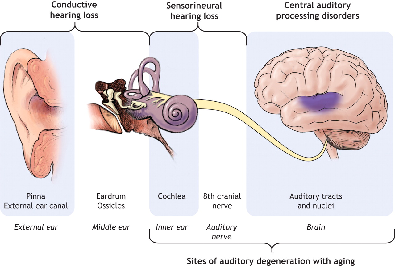 hearing processing