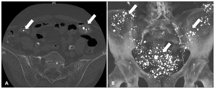 Figure 1: