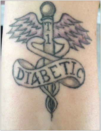 Temporary Diabetes Tattoo Someone I love has T1D  Type W1N