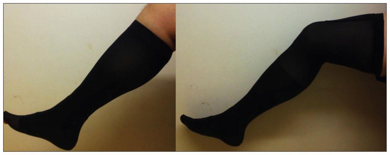 Talking About Graduated Compression Sock and Stocking｜SUNPOLAR
