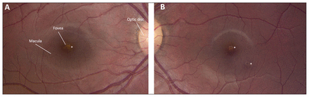 Figure 1: