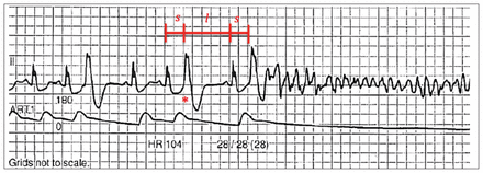 Figure 1: