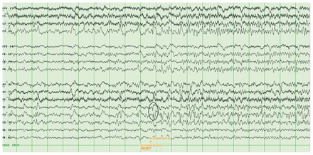 Figure 2: