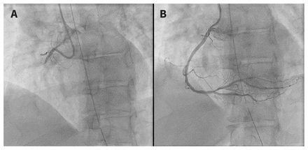 Figure 2: