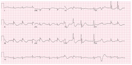 Figure 3: