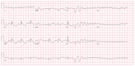 Figure 4: