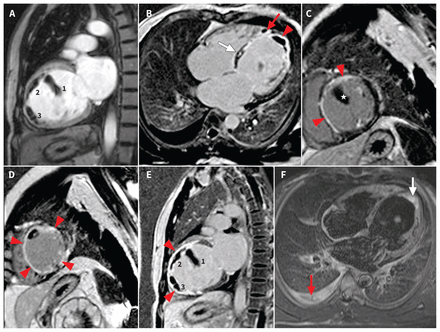 Figure 3: