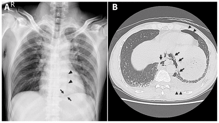 Figure 1: