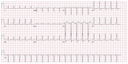 Figure 1: