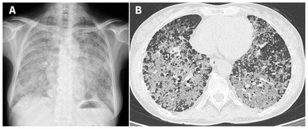 Figure 1: