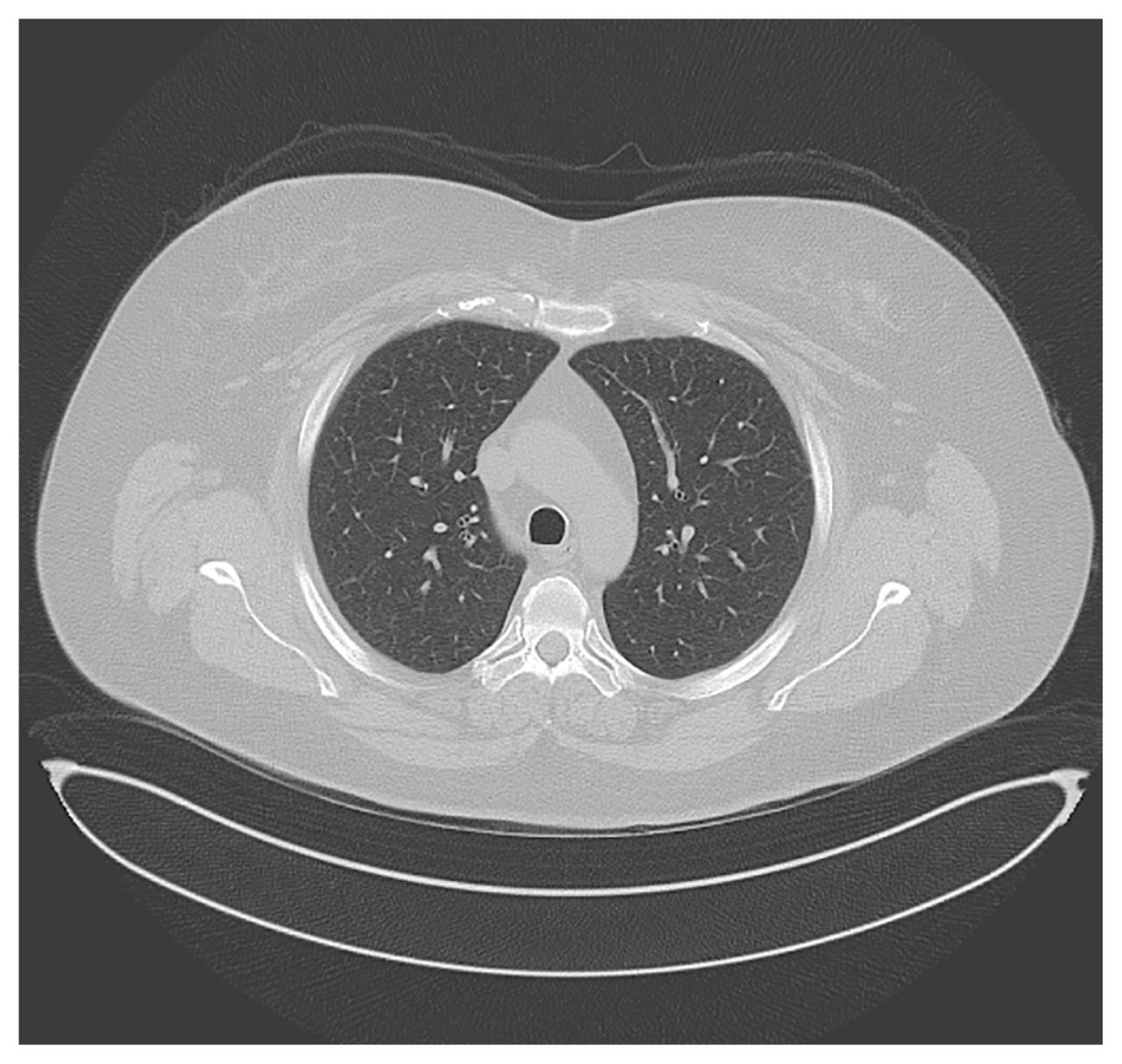 Système d'endoscopie tout-en-un - Medical Expert