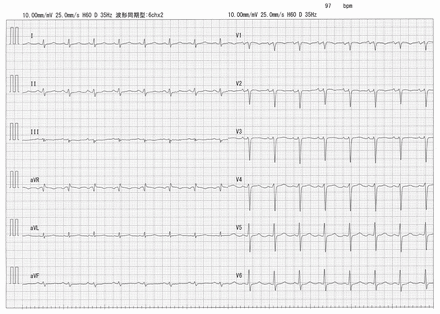 Figure 2: