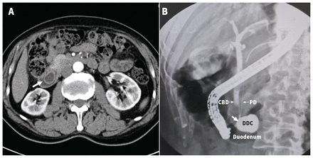 Figure 1: