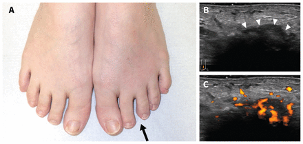 Figure 1: