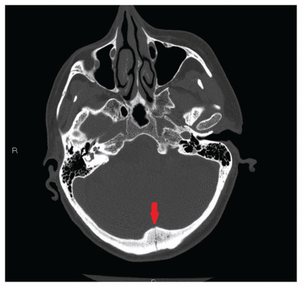 Figure 2: